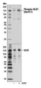 Anti-ULK1 Rabbit Monoclonal Antibody [clone: 13G79]