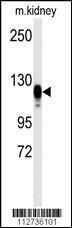 Anti-EGFR Rabbit Polyclonal Antibody (APC (Allophycocyanin))