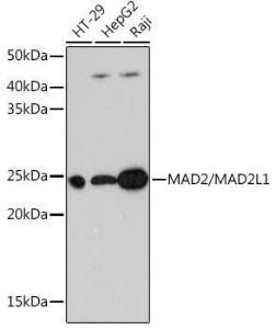 Anti-Mad2L1 Rabbit Monoclonal Antibody [clone: ARC0603]