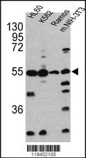 Anti-CASP2 Rabbit Polyclonal Antibody