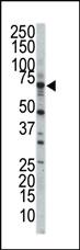 Anti-STK23 (MSSK1) Rabbit Polyclonal Antibody