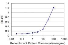 Anti-TESK2 Mouse Monoclonal Antibody [clone: 5C3]