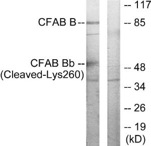 Western blot analysis of lysates from K562 cells, treated with etoposide 25uM 1h using Anti-CFAB Bb (cleaved Lys260) Antibody. The right hand lane represents a negative control, where the antibody is blocked by the immunising peptide.