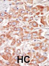 Anti-STK23 (MSSK1) Rabbit Polyclonal Antibody