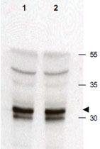 Anti-CDK2 Rabbit Polyclonal Antibody