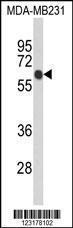 Anti-ANKRD13C Rabbit Polyclonal Antibody (PE (Phycoerythrin))