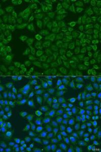 Anti-FMO5 Rabbit Polyclonal Antibody