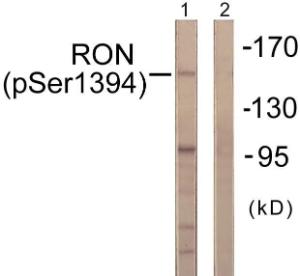 Western blot analysis of lysates from HeLa cells treated with TNF-a 20ng/ml 2' using Anti-CD136 (phospho Ser1394) Antibody. The right hand lane represents a negative control, where the antibody is blocked by the immunising peptide