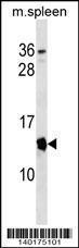 Anti-CDKN2A Rabbit Polyclonal Antibody (AP (Alkaline Phosphatase))