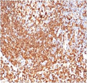 Immunohistochemical analysis of formalin-fixed, paraffin-embedded human lymph node tissue using Anti-CD74 Antibody [CLIP/6609]