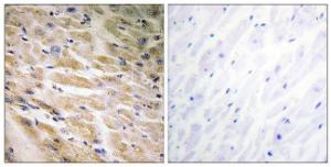 Immunohistochemical analysis of paraffin-embedded human heart using Anti-MEF2C (phospho Ser387) Antibody. The right hand panel represents a negative control, where the Antibody was pre-incubated with the immunising peptide