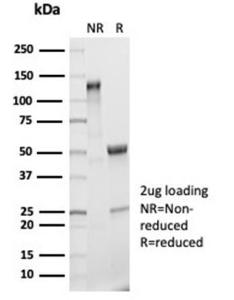 SDS-PAGE analysis of Anti-IL-2 Antibody [IL2/7050R] under non-reduced and reduced conditions; showing intact IgG and intact heavy and light chains, respectively. SDS-PAGE analysis confirms the integrity and purity of the antibody.