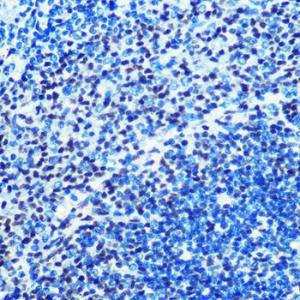 Anti-Mad2L1 Rabbit Monoclonal Antibody [clone: ARC0603]