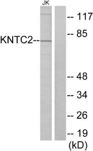 Western blot analysis of lysates from Jurkat cells using Anti-KNTC2 Antibody The right hand lane represents a negative control, where the antibody is blocked by the immunising peptide