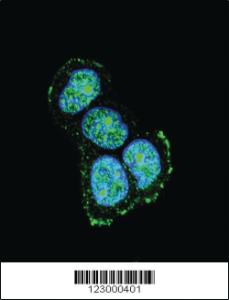 Anti-PSMB5 Rabbit Polyclonal Antibody