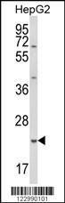 Anti-Glutathione S Transferase alpha 4 Rabbit Polyclonal Antibody (FITC (Fluorescein))