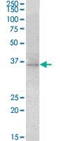 Anti-RDH5 Goat Polyclonal Antibody