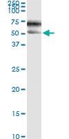 Anti-SERPINA3 Antibody Pair