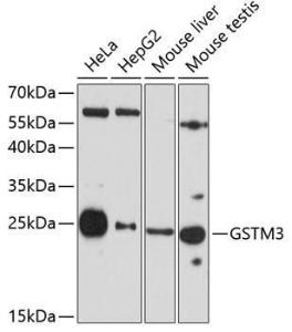 Western blot analysis of extracts of various cell lines, using Anti-GSTM3 Antibody (A10193) at 1:3,000 dilution