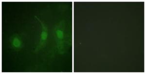 Immunofluorescence analysis of HeLa cells using Anti-IRF-3 (phospho Ser385) Antibody The right hand panel represents a negative control, where the antibody was pre-incubated with the immunising peptide