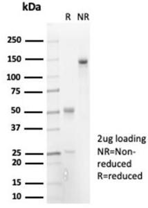 Anti-IL-7 Rabbit Recombinant Antibody [Clone: IL7/7053R]