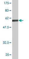 Anti-AIMP1 Mouse Monoclonal Antibody [clone: 3H5]