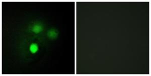 Immunofluorescence analysis of HUVEC cells using Anti-KNTC2 Antibody The right hand panel represents a negative control, where the antibody was pre-incubated with the immunising peptide