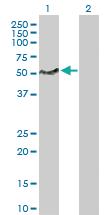 Anti-LSP1 Rabbit Polyclonal Antibody