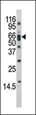 Anti-BACE1 Rabbit Polyclonal Antibody