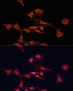 Immunofluorescence analysis of C6 cells using Anti-GSTM3 Antibody (A10193) at a dilution of 1:100. DAPI was used to stain the cell nuclei (blue)