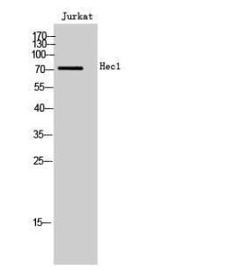 Western blot analysis of Jurkat cells using Anti-KNTC2 Antibody