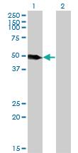 Anti-LSP1 Mouse Monoclonal Antibody [clone: 1C4]