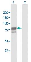 Anti-DHX58 Rabbit Polyclonal Antibody