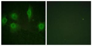 Antibody anti-IL-9R phospho SER519 100 µg