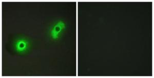 Antibody anti-IK3-2 100 µg