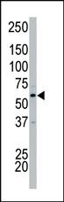 Anti-CDK17 Rabbit Polyclonal Antibody