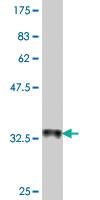 Anti-SAA2 Mouse Polyclonal Antibody