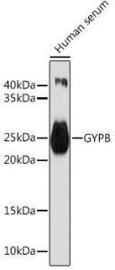 Western blot analysis of extracts of Human serum, using Anti-GYPB / GPB Antibody (A10194) at 1:1000 dilution