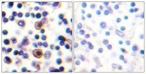 Antibody anti-IL-9R phospho SER519 100 µg