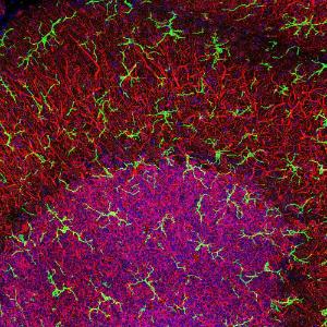 High magnification stacked confocal image of rat cerebellar molecular layer at top and granular layer below, stained with Anti-IBA1 Antibody (1:1,000 / green). Microglia are very small cells with fine processes spreading in three dimensions and so are best visualized in a confocal Z stack.