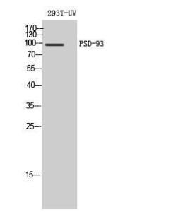 Antibody anti-DLG2 A99910-100 100 µg