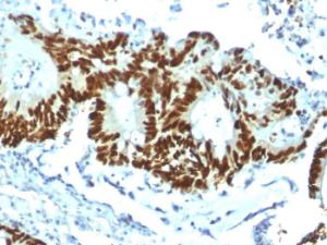 Immunohistochemical analysis of formalin-fixed, paraffin-embedded human tonsil using Anti-p53 Antibody [TP53/1799R]