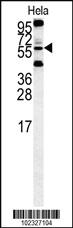 Anti-HTRA1 Rabbit Polyclonal Antibody