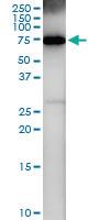 Anti-RNF6 Rabbit Polyclonal Antibody