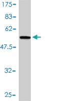 Anti-MTHFD2 Mouse Monoclonal Antibody [clone: 4G7-2G3]