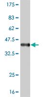 Anti-POU6F1 Mouse Monoclonal Antibody [clone: 6H1]