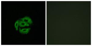 Immunofluorescence analysis of A549 cells using Anti-Cytochrome P450 39A1 Antibody. The right hand panel represents a negative control, where the antibody was pre-incubated with the immunising peptide.