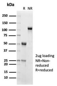 SDS-PAGE analysis of Anti-IL-15 Antibody [IL15/7048R] under non-reduced and reduced conditions; showing intact IgG and intact heavy and light chains, respectively. SDS-PAGE analysis confirms the integrity and purity of the antibody.