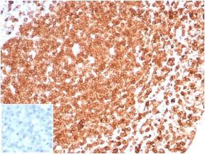 Immunohistochemical analysis of formalin-fixed, paraffin-embedded human tonsil tissue using Anti-CD74 Antibody [CLIP/6609] at 2 µg/ml. Inset: PBS instead of the primary Antibody. Secondary Antibody negative control