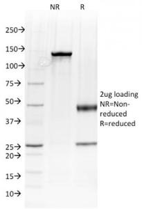 SDS-PAGE analysis of Anti-Albumin Antibody [ALB/2144] under non-reduced and reduced conditions; showing intact IgG and intact heavy and light chains, respectively. SDS-PAGE analysis confirms the integrity and purity of the antibody